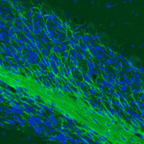 MOG Antibody (CL2852) Immunohistochemistry: MOG Antibody (CL2852) [NBP3-52462]
