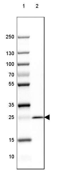 MOG Antibody (CL2852) Western Blot: MOG Antibody (CL2852) [NBP3-52462]