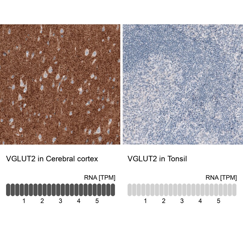 VGLUT2 Antibody (CL2921) Immunohistochemistry: VGLUT2 Antibody (CL2921) [NBP3-52463]
