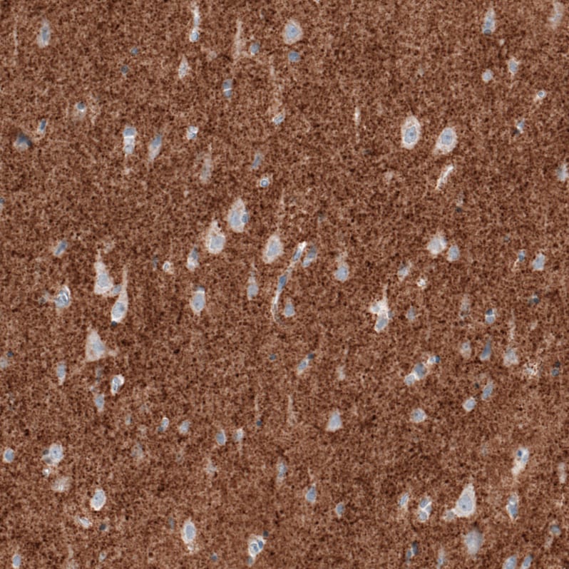 Immunohistochemistry-Paraffin: VGLUT2 Antibody (CL2921) [NBP3-52463]