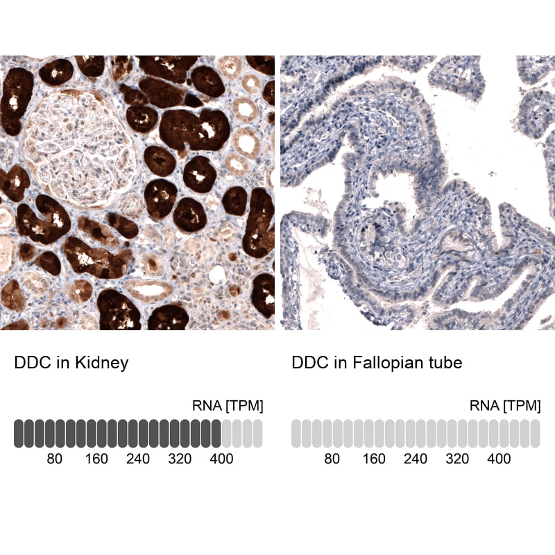 Dopa Decarboxylase/DDC Antibody (CL2962) Immunohistochemistry: Dopa Decarboxylase/DDC Antibody (CL2962) [NBP3-52464]