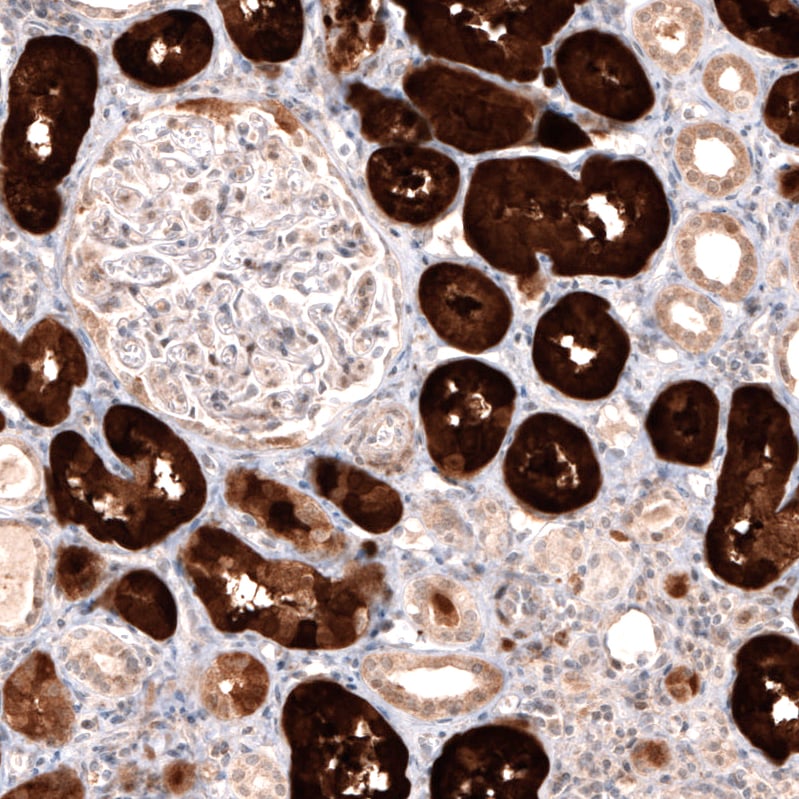 Dopa Decarboxylase/DDC Antibody (CL2962) Immunohistochemistry: Dopa Decarboxylase/DDC Antibody (CL2962) [NBP3-52464]