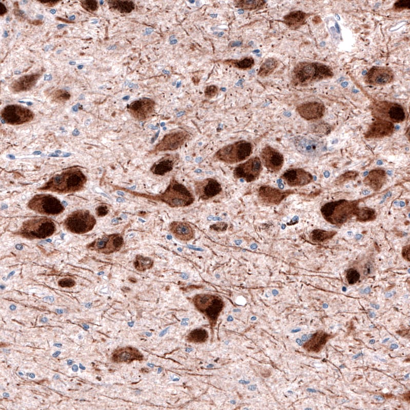 Dopa Decarboxylase/DDC Antibody (CL2962) Immunohistochemistry: Dopa Decarboxylase/DDC Antibody (CL2962) [NBP3-52464]