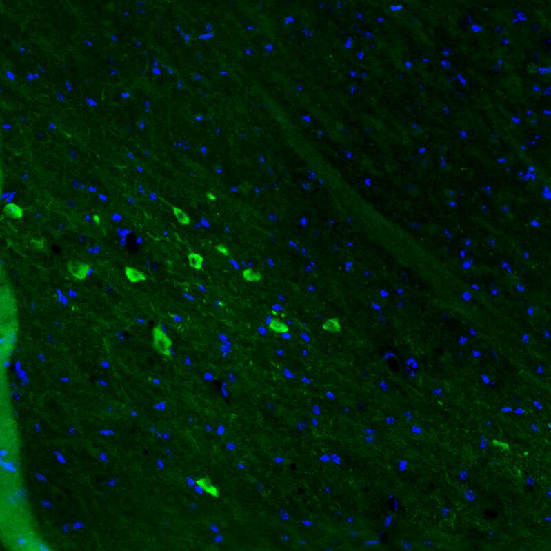 Dopa Decarboxylase/DDC Antibody (CL2962) Immunohistochemistry: Dopa Decarboxylase/DDC Antibody (CL2962) [NBP3-52464]