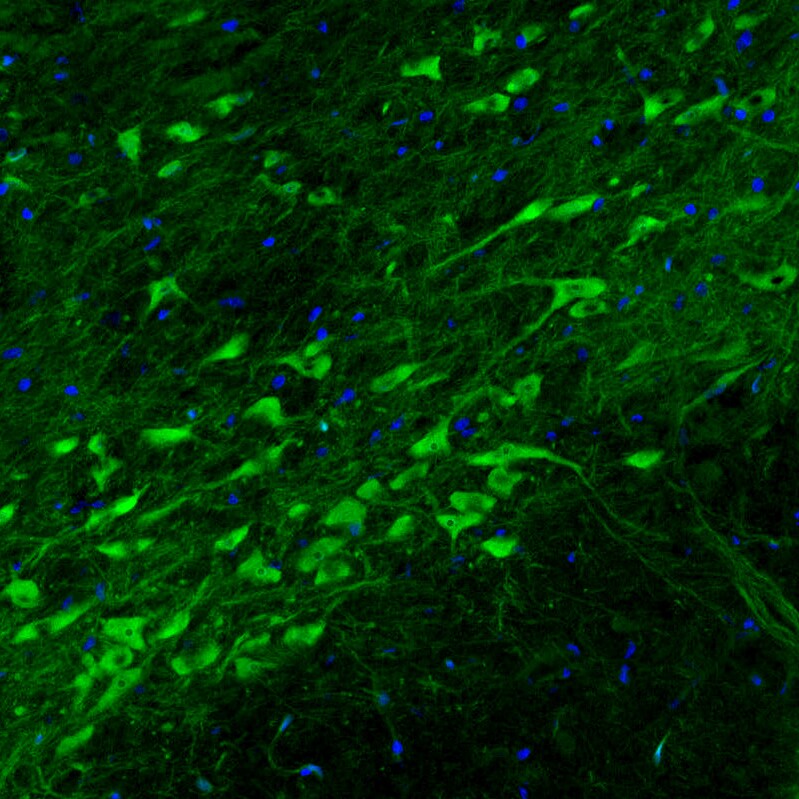 Dopa Decarboxylase/DDC Antibody (CL2962) Immunohistochemistry: Dopa Decarboxylase/DDC Antibody (CL2962) [NBP3-52464]