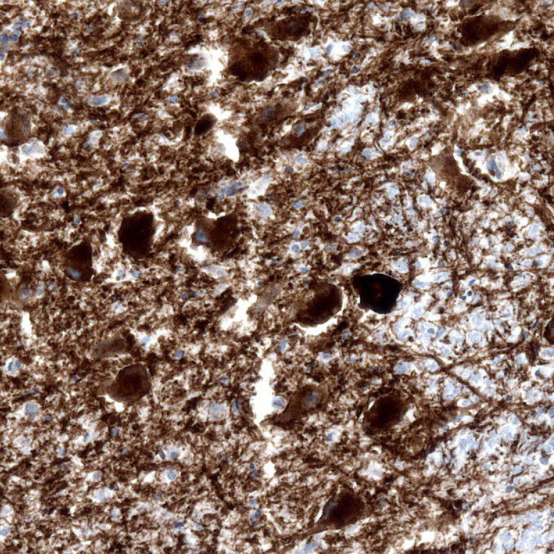 SLC6A2/NET/Noradrenaline transporter Antibody (CL3063) Immunohistochemistry: SLC6A2/NET/Noradrenaline transporter Antibody (CL3063) [NBP3-52466]