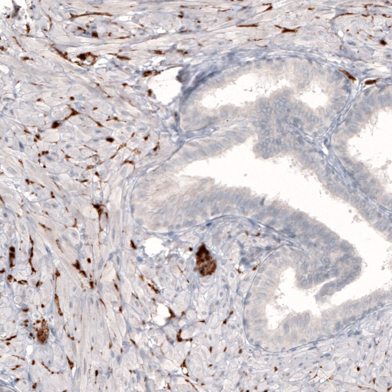 SLC6A2/NET/Noradrenaline transporter Antibody (CL3063) Immunohistochemistry: SLC6A2/NET/Noradrenaline transporter Antibody (CL3063) [NBP3-52466]