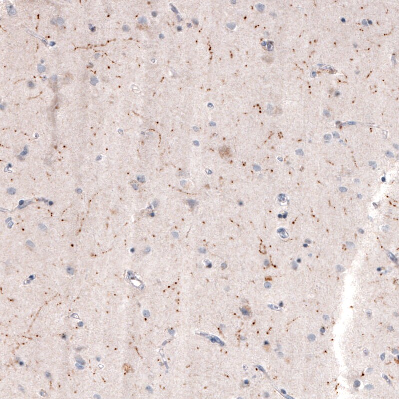 Choline Acetyltransferase/ChAT Antibody (CL3173) Immunohistochemistry: Choline Acetyltransferase/ChAT Antibody (CL3173) [NBP3-52467]