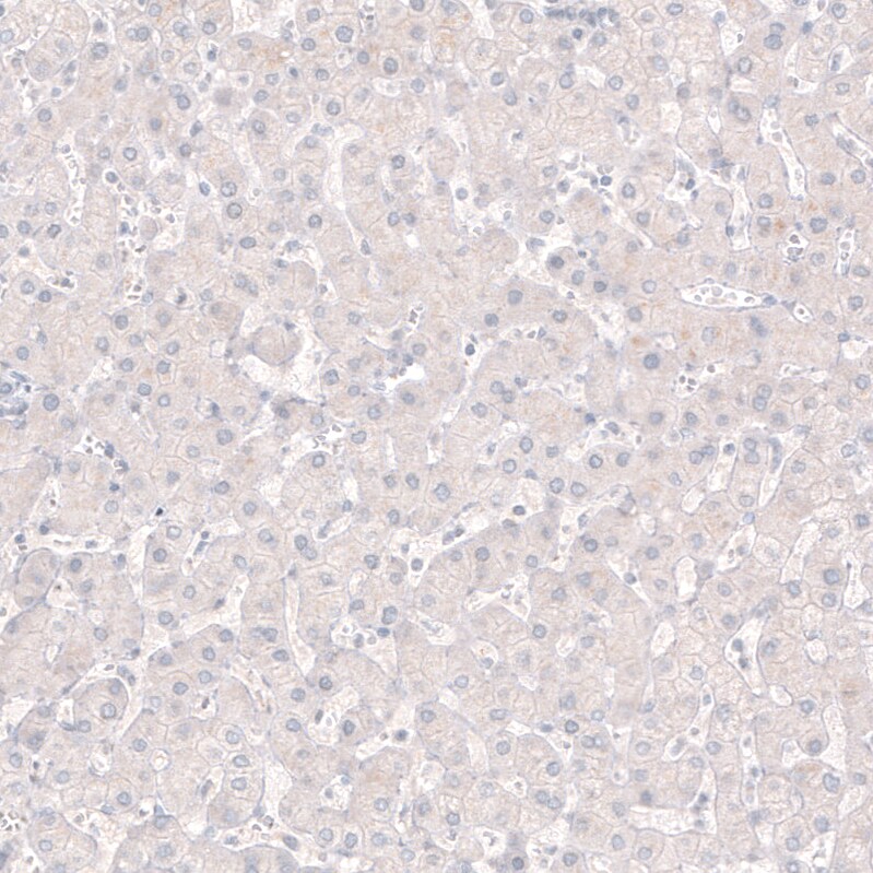 Choline Acetyltransferase/ChAT Antibody (CL3173) Immunohistochemistry: Choline Acetyltransferase/ChAT Antibody (CL3173) [NBP3-52467]