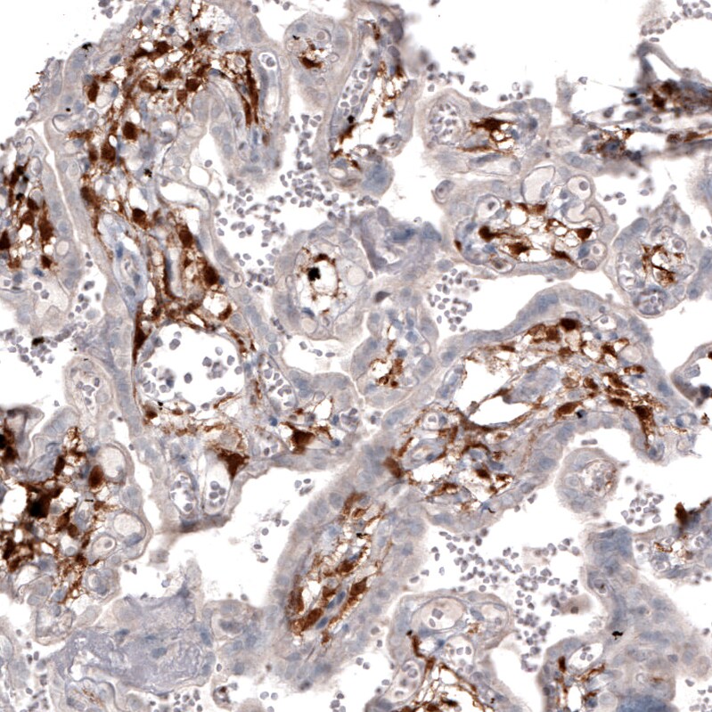 Choline Acetyltransferase/ChAT Antibody (CL3173) Immunohistochemistry: Choline Acetyltransferase/ChAT Antibody (CL3173) [NBP3-52467]