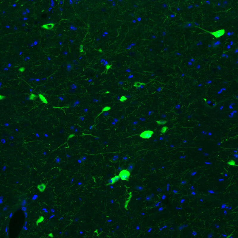 Choline Acetyltransferase/ChAT Antibody (CL3173) Immunohistochemistry: Choline Acetyltransferase/ChAT Antibody (CL3173) [NBP3-52467]