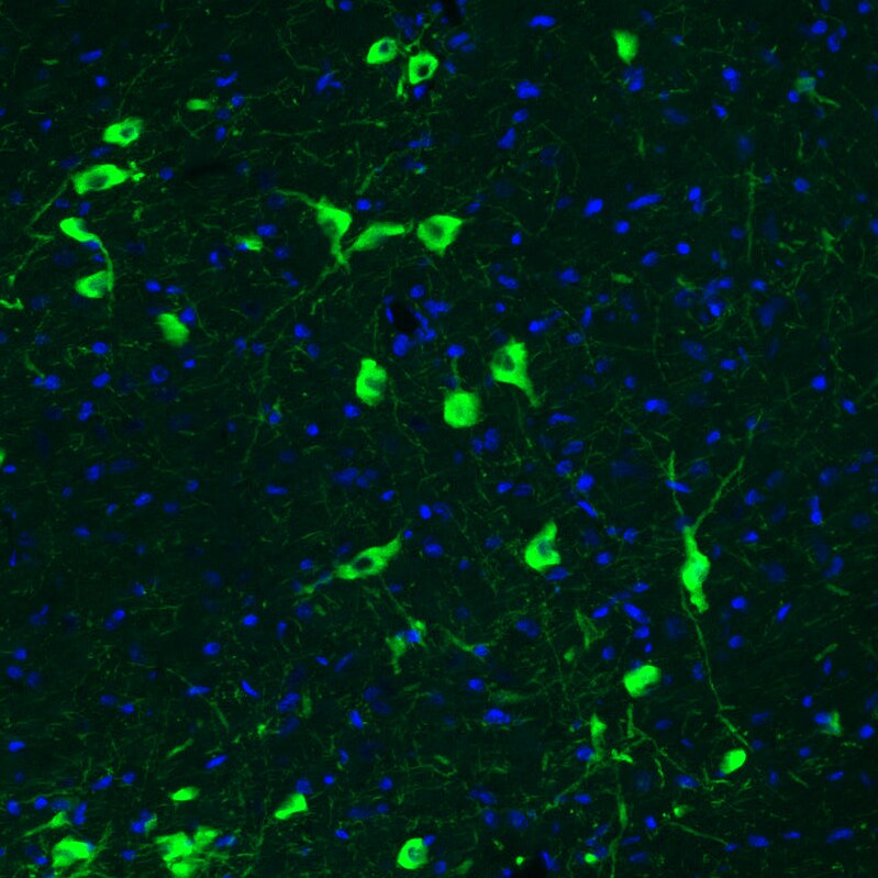 Choline Acetyltransferase/ChAT Antibody (CL3173) Immunohistochemistry: Choline Acetyltransferase/ChAT Antibody (CL3173) [NBP3-52467]