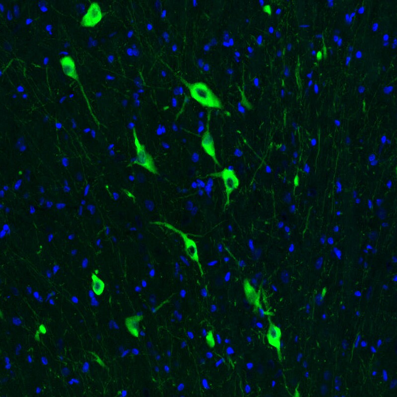 Choline Acetyltransferase/ChAT Antibody (CL3173) Immunohistochemistry: Choline Acetyltransferase/ChAT Antibody (CL3173) [NBP3-52467]