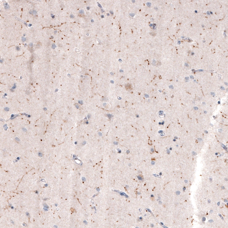 Immunohistochemistry-Paraffin: Choline Acetyltransferase/ChAT Antibody (CL3173) [NBP3-52467]