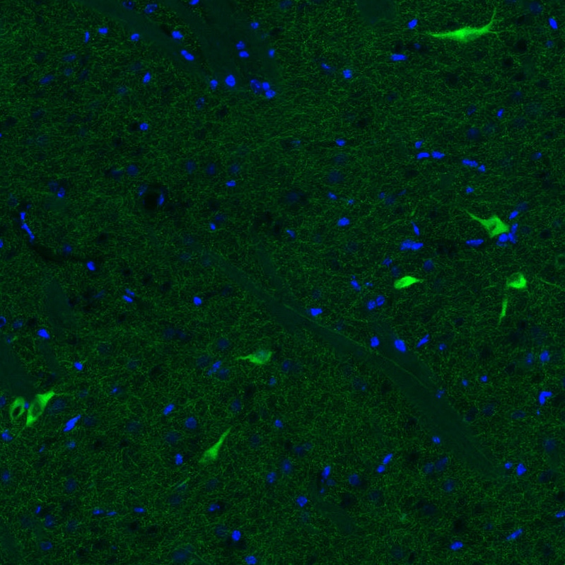 Immunohistochemistry-Paraffin: Choline Acetyltransferase/ChAT Antibody (CL3173) [NBP3-52467]