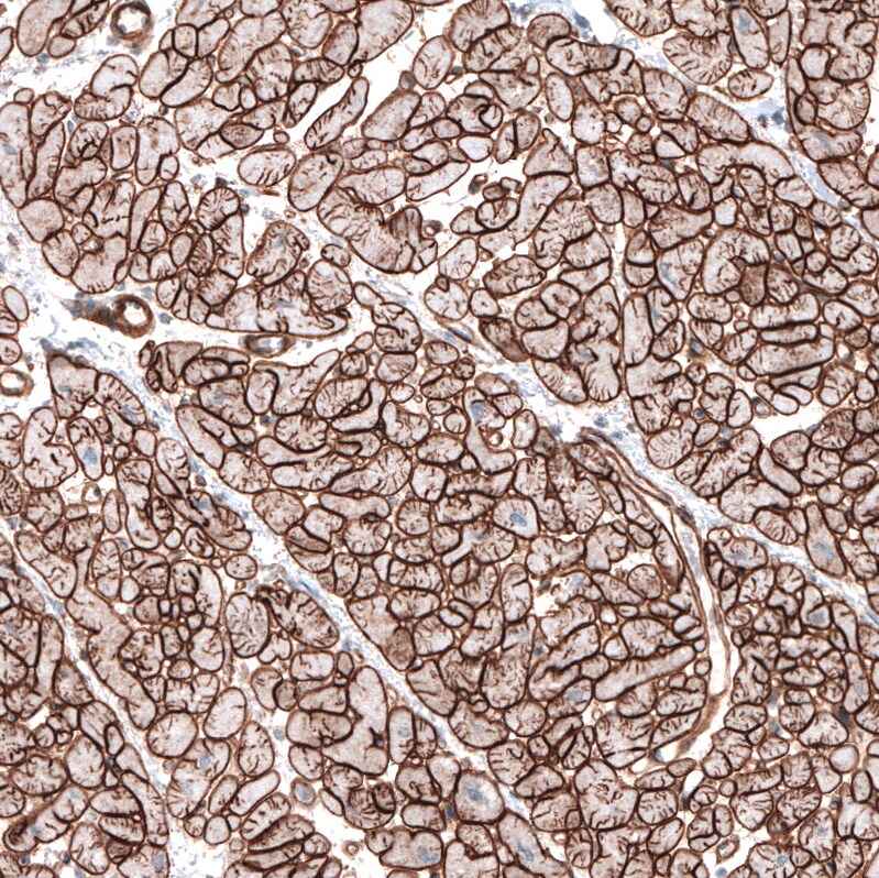 Laminin gamma 1 Antibody (CL3196) Immunohistochemistry: Laminin gamma 1 Antibody (CL3196) [NBP3-52468]