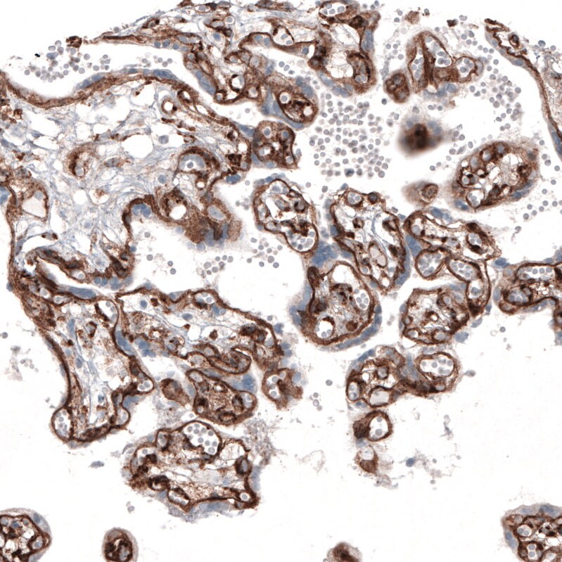 Laminin gamma 1 Antibody (CL3196) Immunohistochemistry: Laminin gamma 1 Antibody (CL3196) [NBP3-52468]