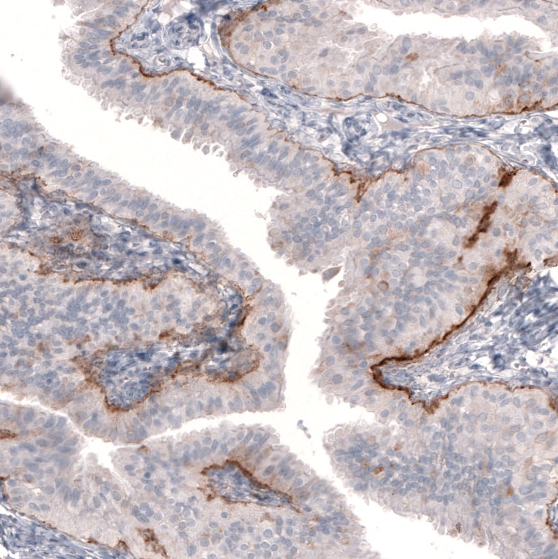 Immunohistochemistry-Paraffin: Laminin beta 3 Antibody (CL3353) [NBP3-52469]