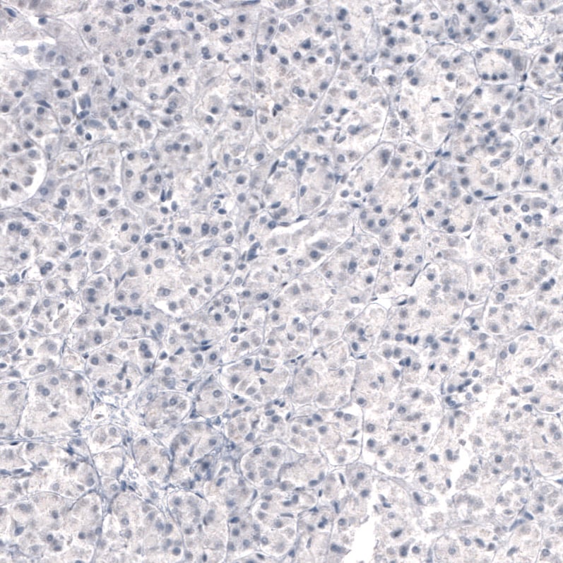 Immunohistochemistry-Paraffin: Laminin beta 3 Antibody (CL3353) [NBP3-52469]