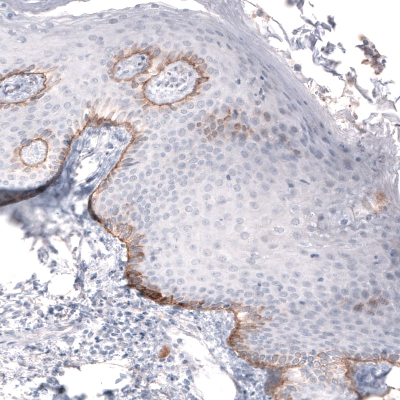 Immunohistochemistry-Paraffin: Laminin beta 3 Antibody (CL3353) [NBP3-52469]