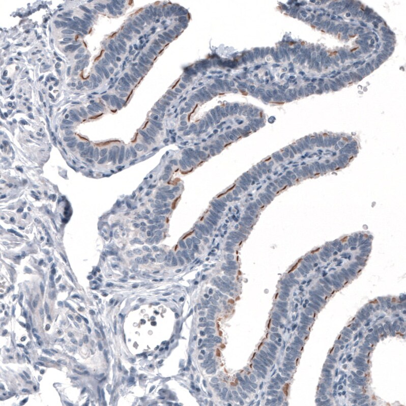 CEP350 Antibody (CL3423) Immunohistochemistry: CEP350 Antibody (CL3423) [NBP3-52470]