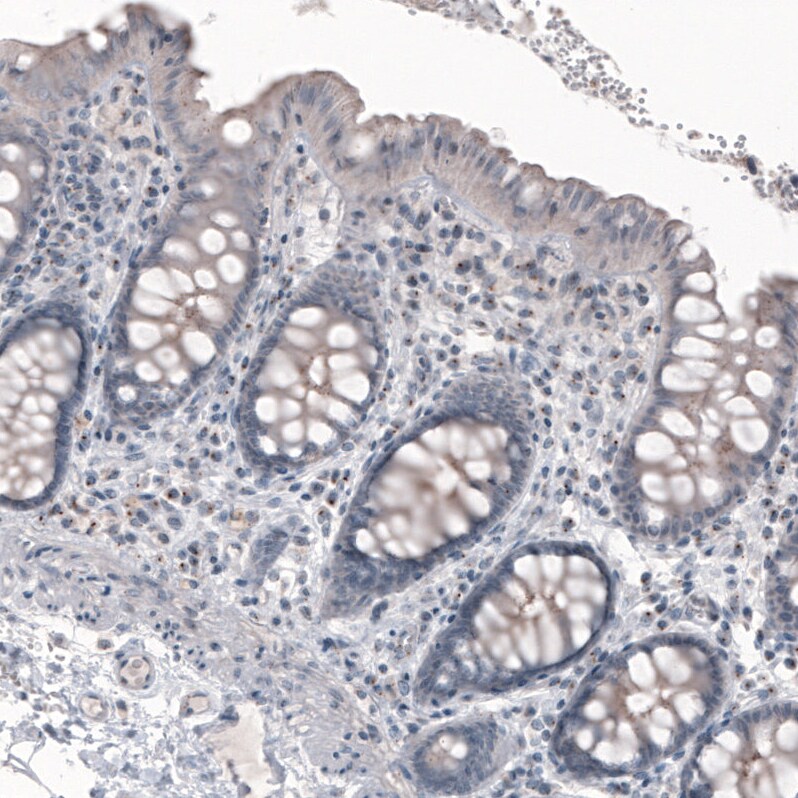 CEP350 Antibody (CL3423) Immunohistochemistry: CEP350 Antibody (CL3423) [NBP3-52470]
