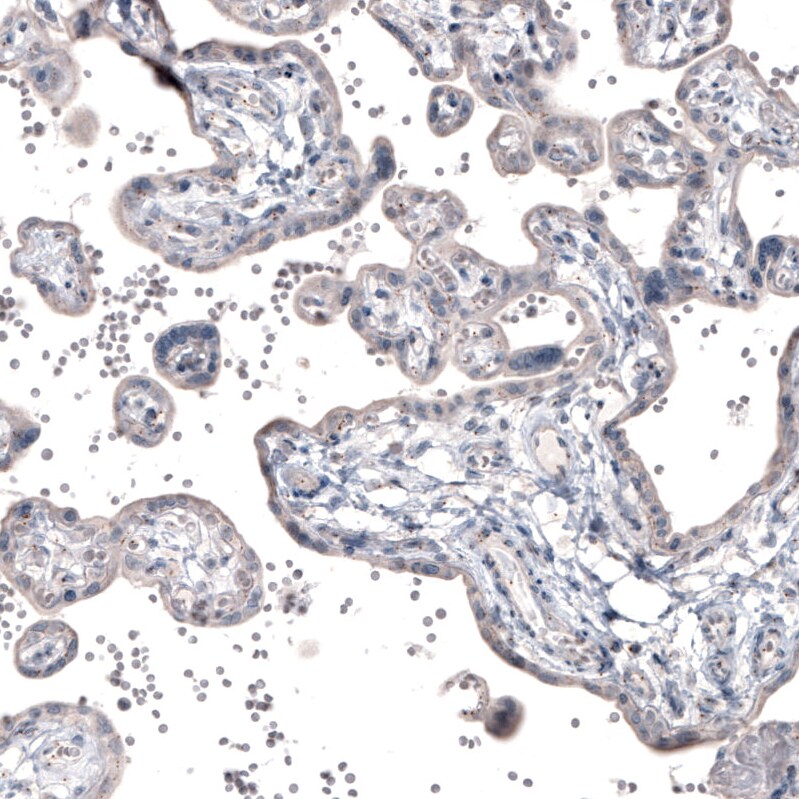 CEP350 Antibody (CL3423) Immunohistochemistry: CEP350 Antibody (CL3423) [NBP3-52470]