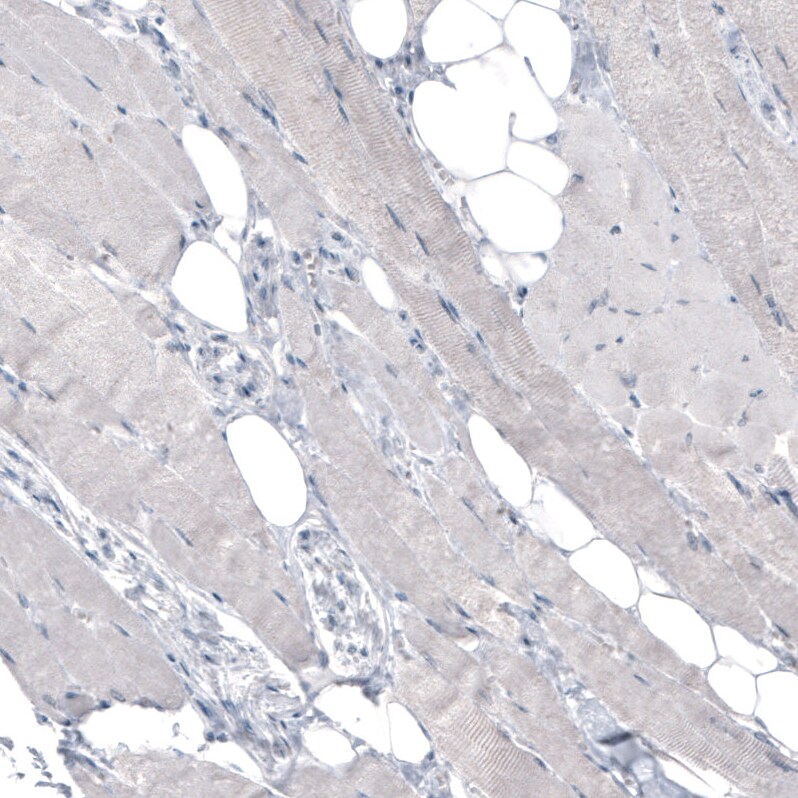 CEP350 Antibody (CL3423) Immunohistochemistry: CEP350 Antibody (CL3423) [NBP3-52470]