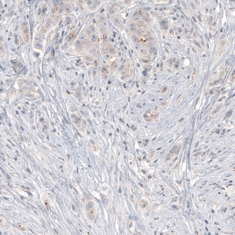 Immunohistochemistry-Paraffin: CEP350 Antibody (CL3423) [NBP3-52470]