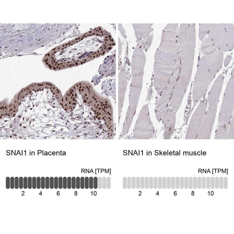 Snail Antibody (CL3700) Immunohistochemistry: Snail Antibody (CL3700) [NBP3-52471]