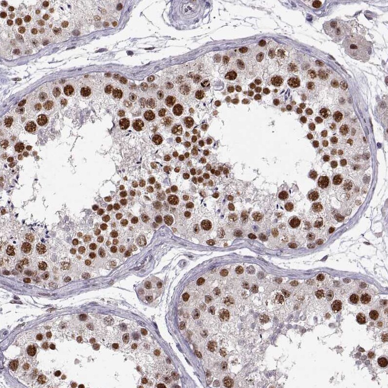 Snail Antibody (CL3700) Immunohistochemistry: Snail Antibody (CL3700) [NBP3-52471]