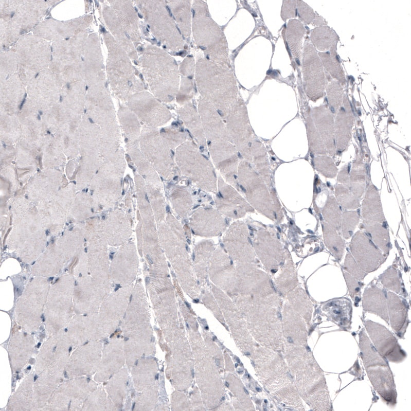 THSD7A Antibody (CL3778) Immunohistochemistry: THSD7A Antibody (CL3778) [NBP3-52472]