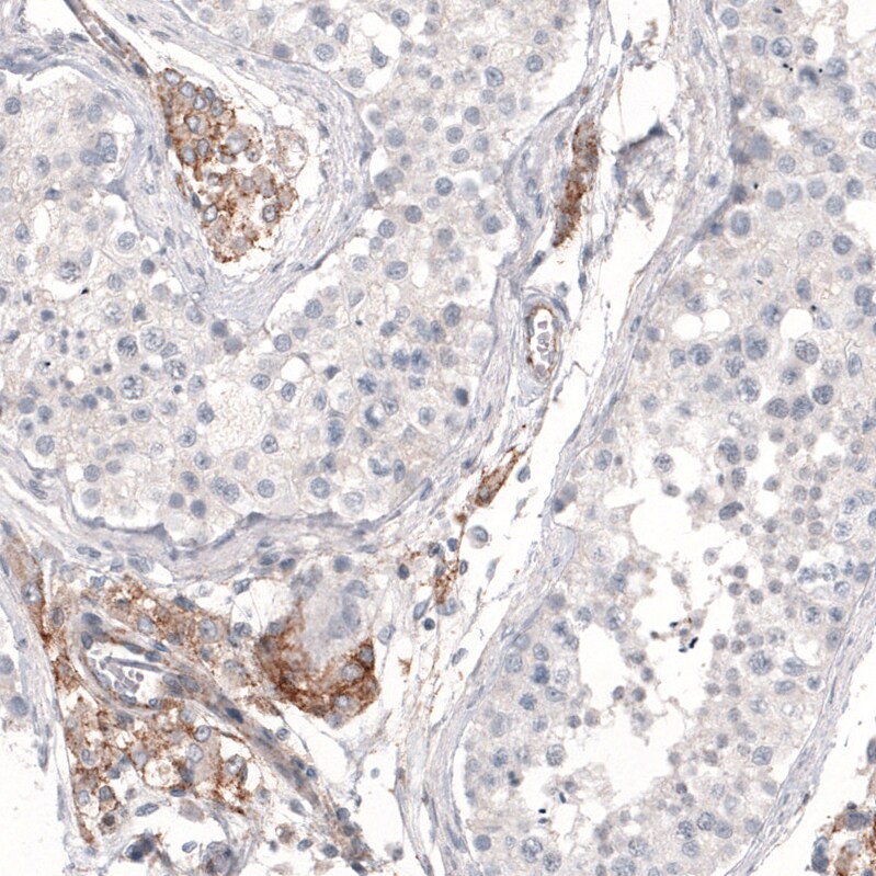 THSD7A Antibody (CL3778) Immunohistochemistry: THSD7A Antibody (CL3778) [NBP3-52472]