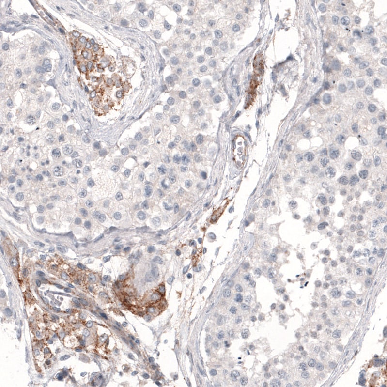 Immunohistochemistry-Paraffin: THSD7A Antibody (CL3778) [NBP3-52472]