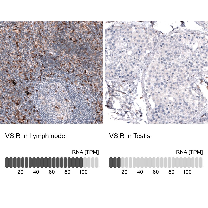 VISTA/B7-H5/PD-1H Antibody (CL3975) Immunohistochemistry: VISTA/B7-H5/PD-1H Antibody (CL3975) [NBP3-52473]
