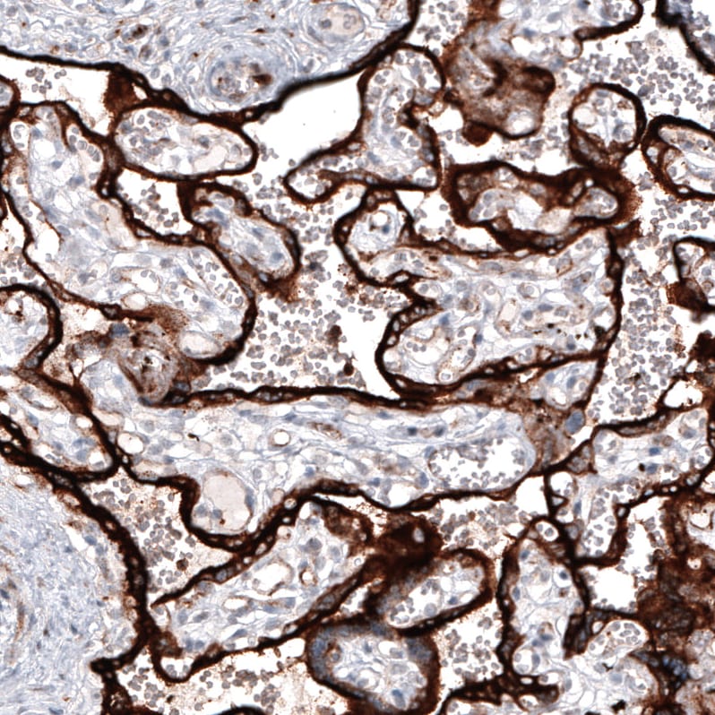 VISTA/B7-H5/PD-1H Antibody (CL3975) Immunohistochemistry: VISTA/B7-H5/PD-1H Antibody (CL3975) [NBP3-52473]