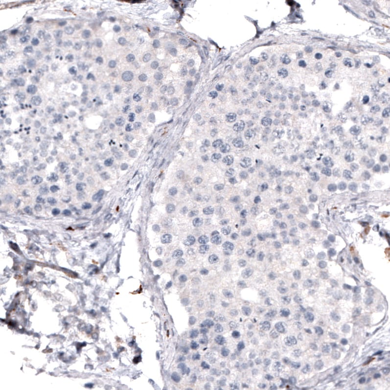 VISTA/B7-H5/PD-1H Antibody (CL3975) Immunohistochemistry: VISTA/B7-H5/PD-1H Antibody (CL3975) [NBP3-52473]