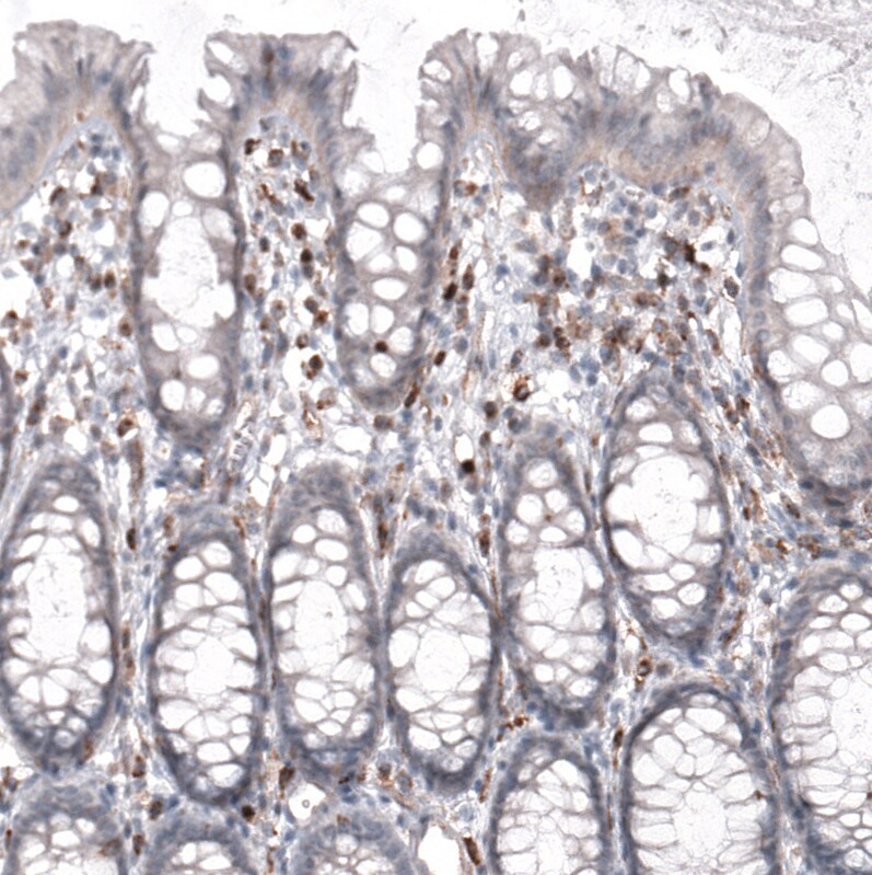 VISTA/B7-H5/PD-1H Antibody (CL3975) Immunohistochemistry: VISTA/B7-H5/PD-1H Antibody (CL3975) [NBP3-52473]