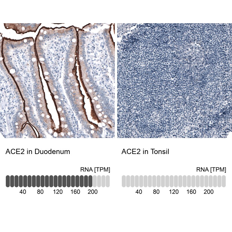 ACE-2 Antibody (CL4035) Immunohistochemistry: ACE-2 Antibody (CL4035) [NBP3-52474]