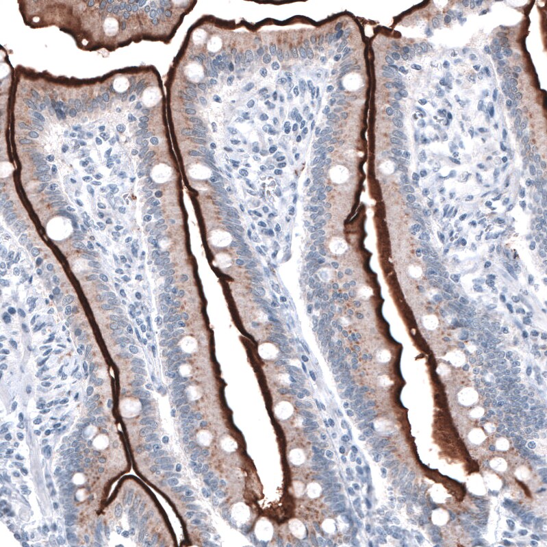 ACE-2 Antibody (CL4035) Immunohistochemistry: ACE-2 Antibody (CL4035) [NBP3-52474]