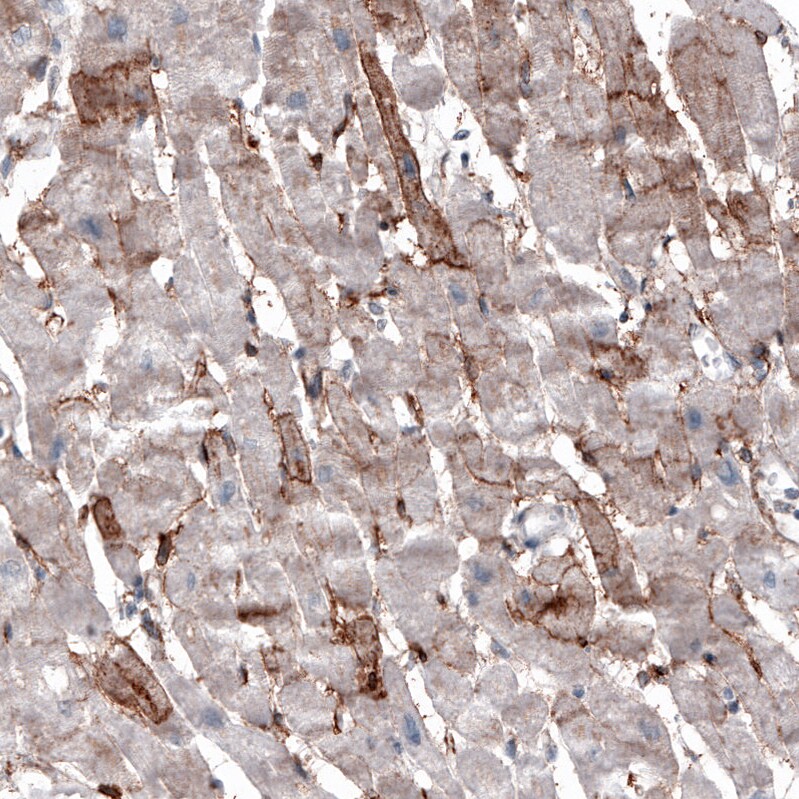 ACE-2 Antibody (CL4035) Immunohistochemistry: ACE-2 Antibody (CL4035) [NBP3-52474]
