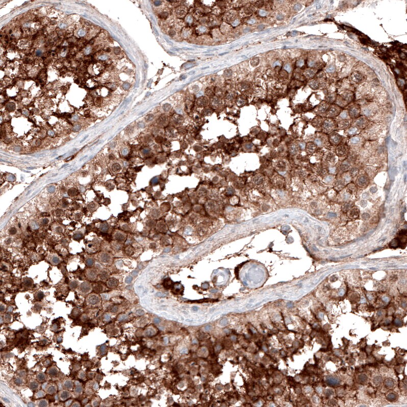 ACE-2 Antibody (CL4035) Immunohistochemistry: ACE-2 Antibody (CL4035) [NBP3-52474]