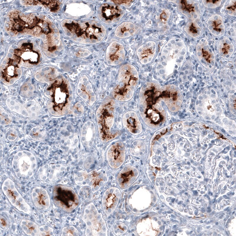 ACE-2 Antibody (CL4035) Immunohistochemistry: ACE-2 Antibody (CL4035) [NBP3-52474]