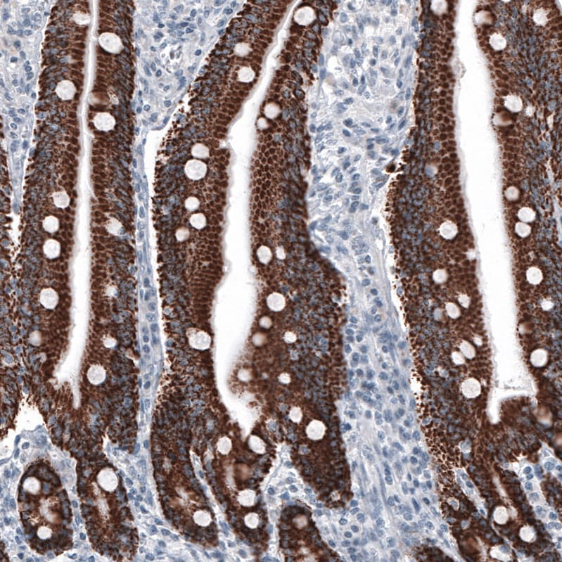Ornithine Carbamoyltransferase Antibody (CL4045) Immunohistochemistry: Ornithine Carbamoyltransferase Antibody (CL4045) [NBP3-52475]