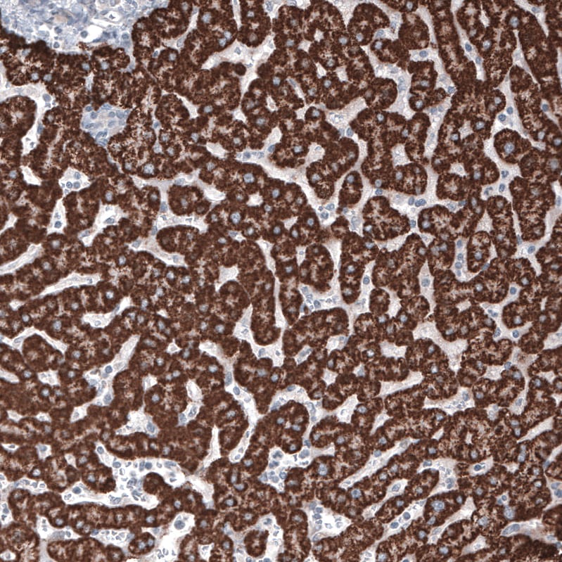 Ornithine Carbamoyltransferase Antibody (CL4045) Immunohistochemistry: Ornithine Carbamoyltransferase Antibody (CL4045) [NBP3-52475]