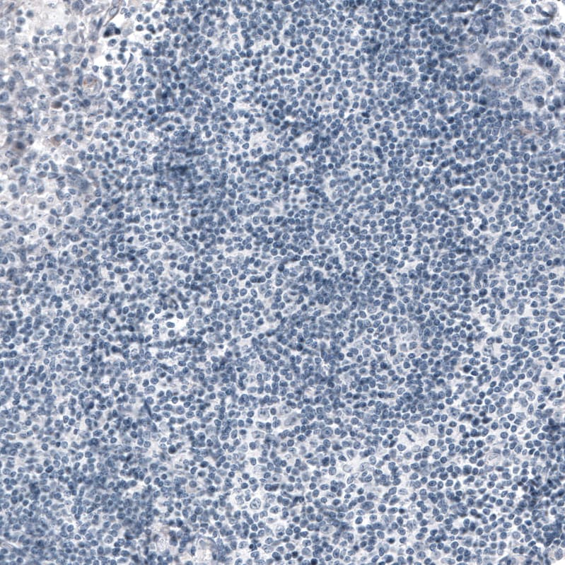 Ornithine Carbamoyltransferase Antibody (CL4045) Immunohistochemistry: Ornithine Carbamoyltransferase Antibody (CL4045) [NBP3-52475]