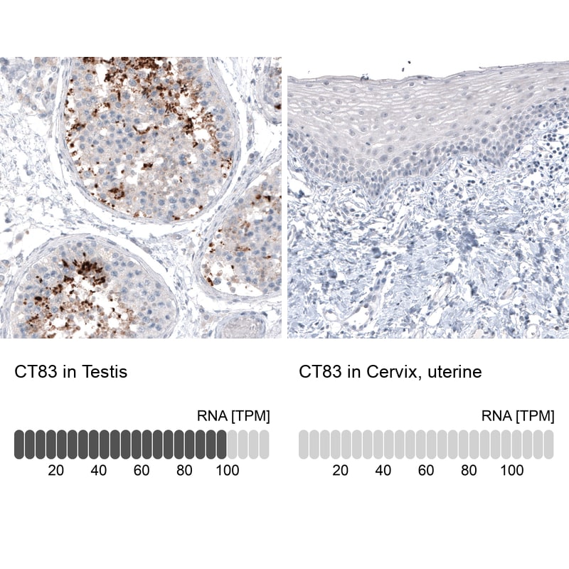 CT83 Antibody (CL4762) Immunohistochemistry: CT83 Antibody (CL4762) [NBP3-52476]