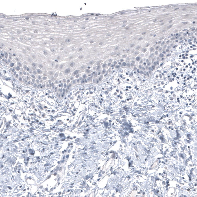 CT83 Antibody (CL4762) Immunohistochemistry: CT83 Antibody (CL4762) [NBP3-52476]