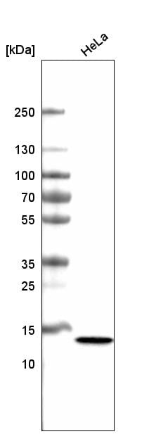 CT83 Antibody (CL4762) Western Blot: CT83 Antibody (CL4762) [NBP3-52476]