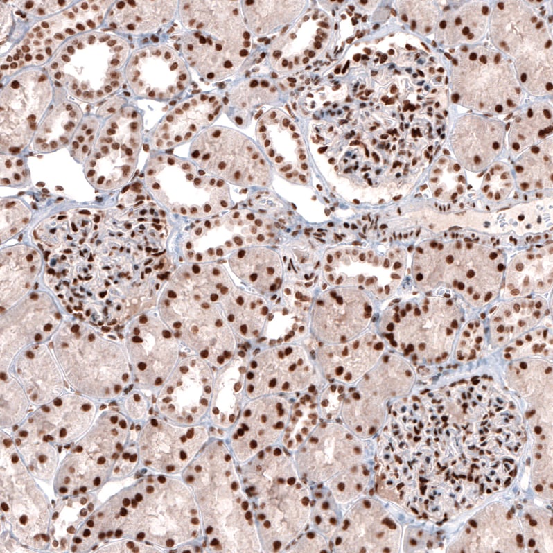 CDP/CUTL1 Antibody (CL5278) Immunohistochemistry: CDP/CUTL1 Antibody (CL5278) [NBP3-52477]